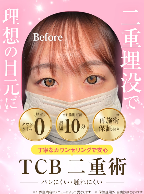TCBの二重整形