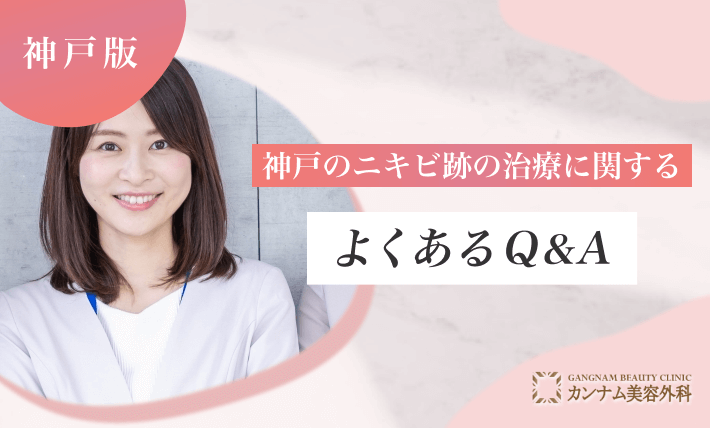 神戸のニキビ跡治療に関するよくあるQ&A