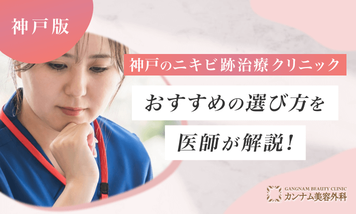 神戸のニキビ跡治療クリニックおすすめの選び方を医師が解説！