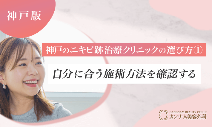 神戸のニキビ跡治療クリニックの選び方① 自分に合う施術方法を確認する