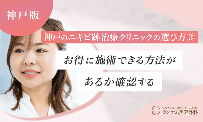 神戸のニキビ跡治療クリニックの選び方③ お得に施術できる方法があるか確認する