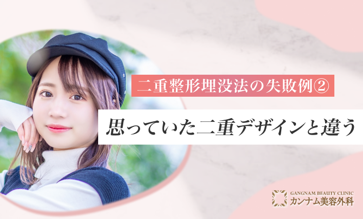 二重整形埋没法の失敗例② 思っていた二重デザインと違う