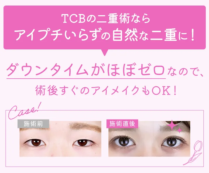 TCBの二重術の症例写真