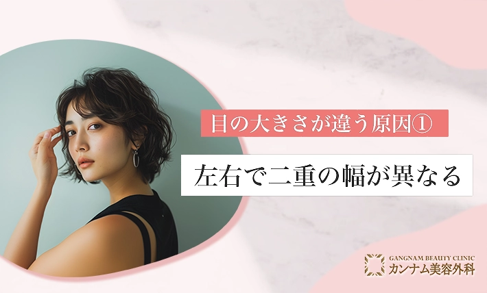 目の大きさが違う原因①左右で二重の幅が異なる