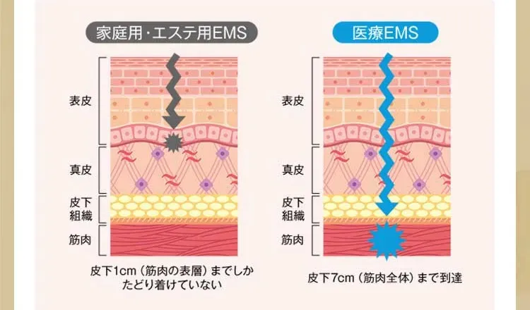 家庭用EMSと医療EMSの違い