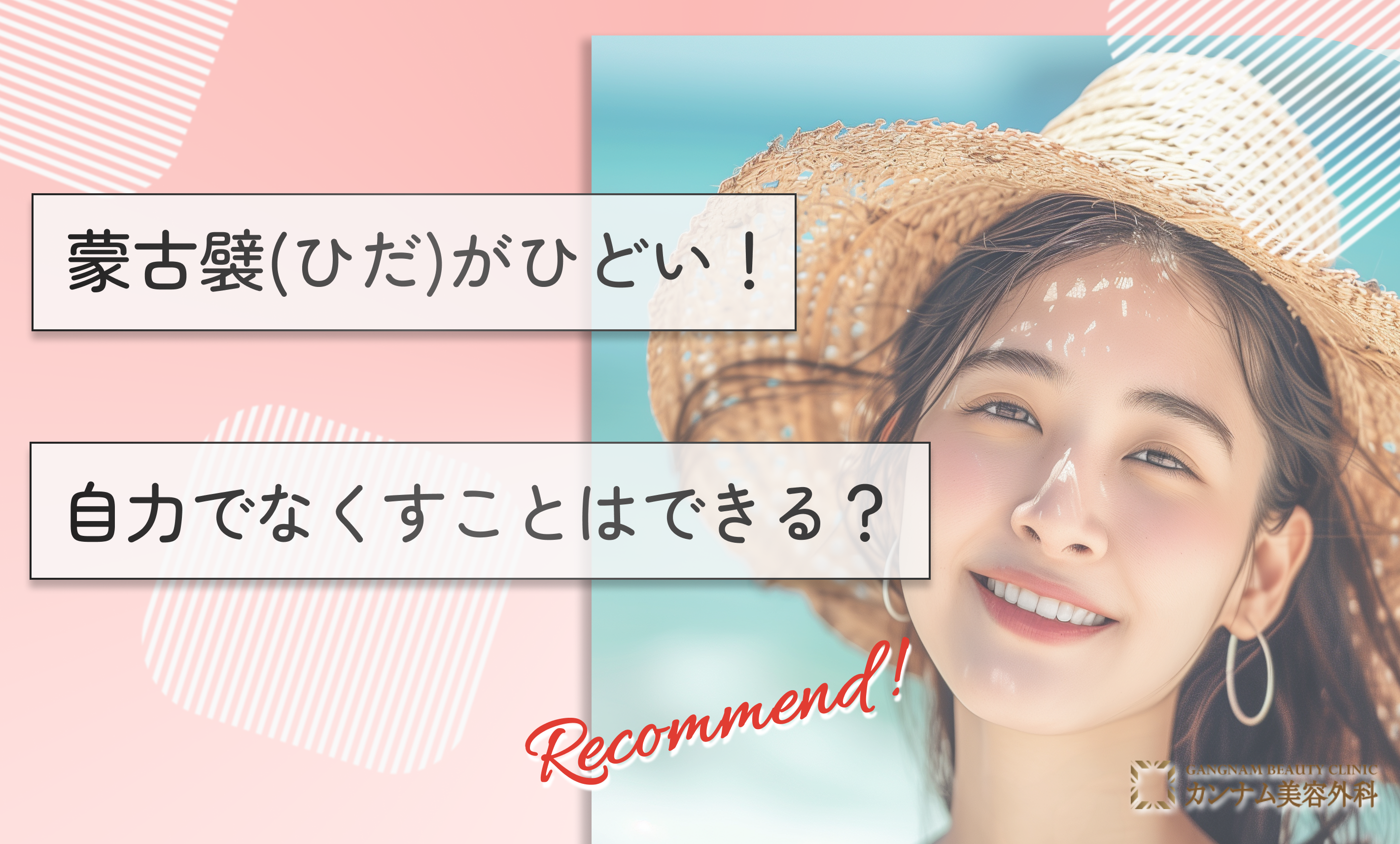 蒙古襞(ひだ)がひどい！自力でなくすことはできる？