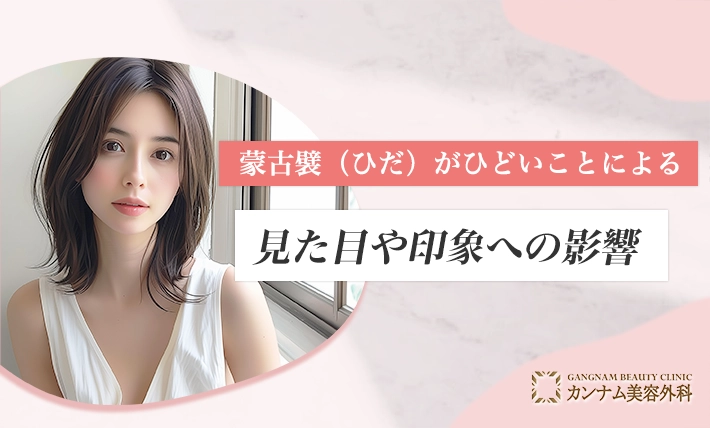 蒙古襞(ひだ)がひどいことによる見た目や印象への影響