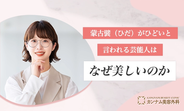 蒙古襞(ひだ)がひどいと言われる芸能人はなぜ美しいのか