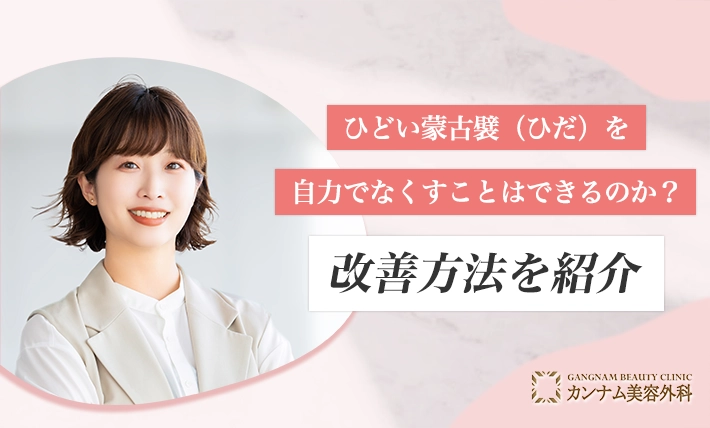 ひどい蒙古襞(ひだ)を自力でなくすことはできるのか?改善方法を紹介