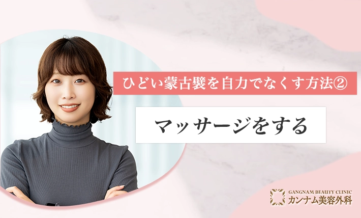 ひどい蒙古襞を自力でなくす方法②マッサージをする