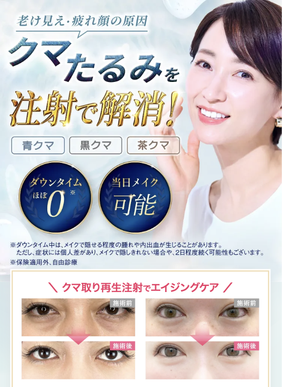 TCBのクマ取り再生注射