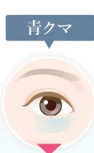 青クマの画像
