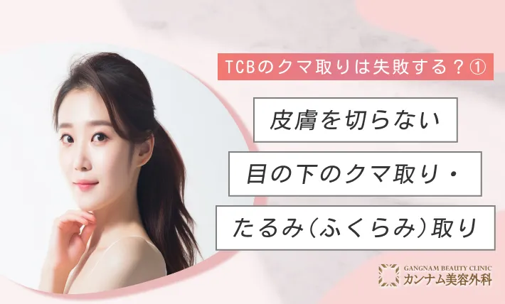TCBのクマ取りは失敗する? ① 皮膚を切らない目の下のクマ取り・たるみ(ふくらみ)取り