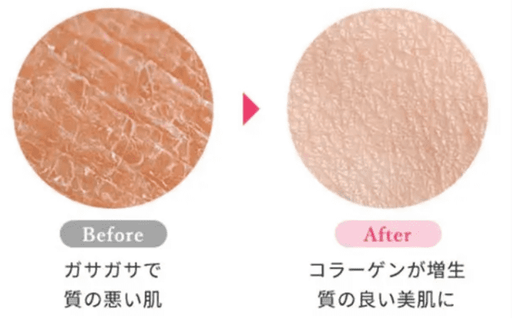 コラーゲンによる美肌効果