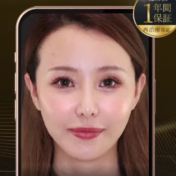 TAクリニック の糸リフトのイメージ