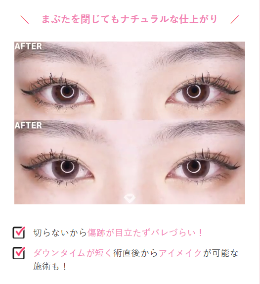ナチュラルな仕上がりでばれづらい