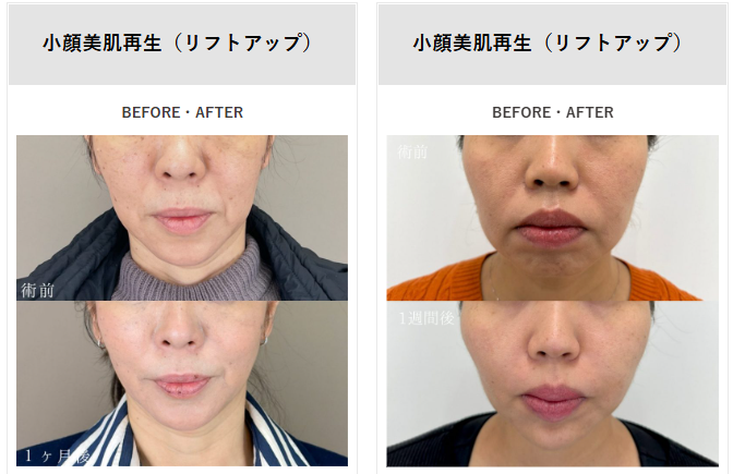 TCBの年齢問わず公開されている症例写真