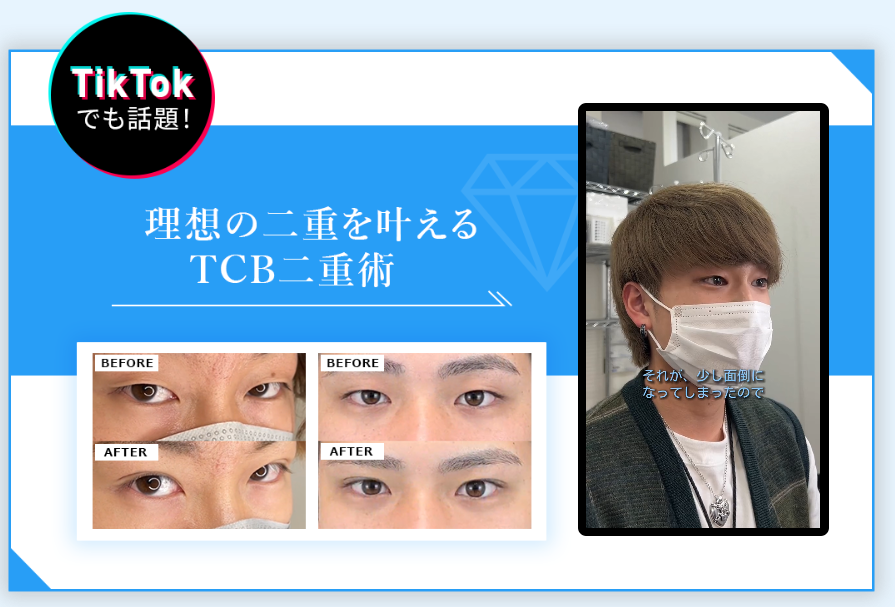 理想の二重を叶えるTCB