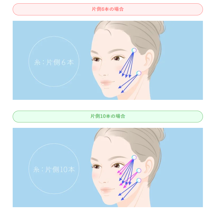 TCBの糸の本数目安