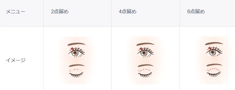 ジュノビューティークリニック(Juno)の二重整形の口コミ評判【4,800円  