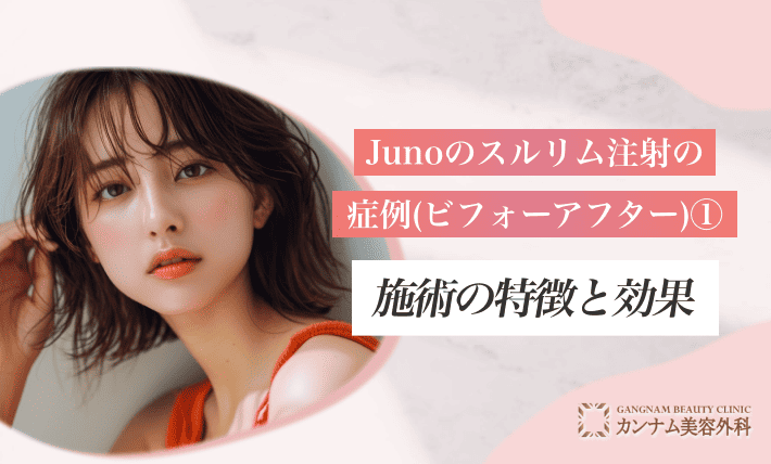 Junoのスルリム注射の症例(ビフォーアフター)① 施術の特徴と効果