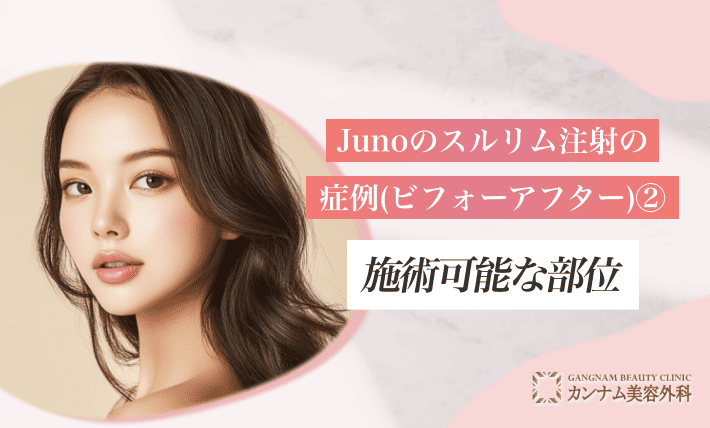 Junoのスルリム注射の症例(ビフォーアフター)② 施術可能な部位