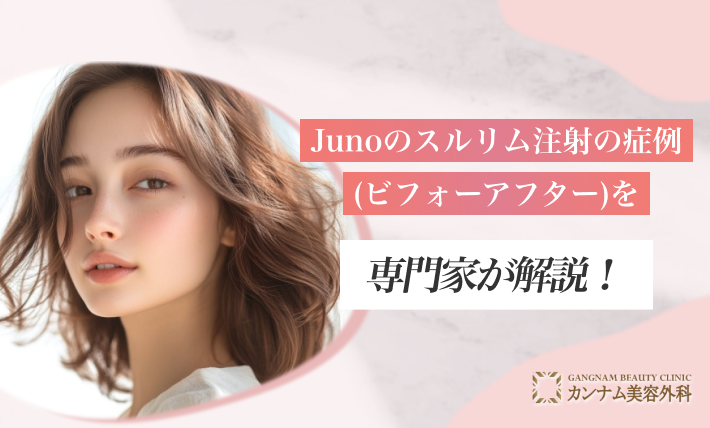 Junoのスルリム注射の症例(ビフォーアフター)を専門家が解説！