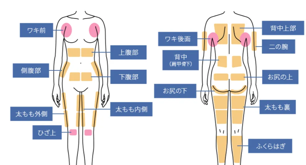 スルリム注射のエリア分類 胴体部分