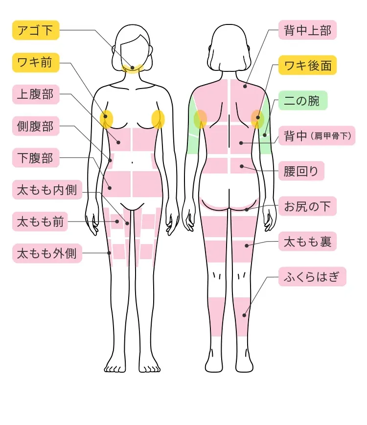 スルリム注射の施術可能部位