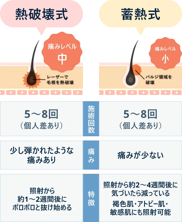 医療脱毛の熱破壊式と蓄熱式