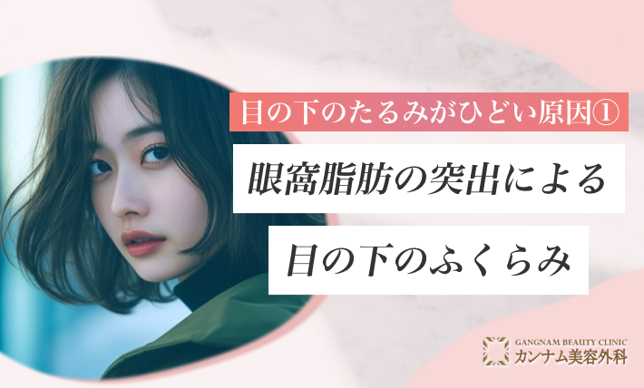 目の下のたるみがひどい原因① 眼窩脂肪の突出による目の下のふくらみ