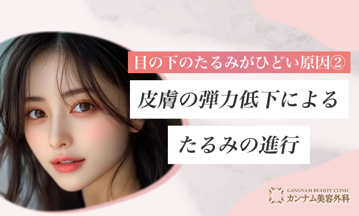目の下のたるみがひどい原因② 皮膚の弾力低下によるたるみの進行