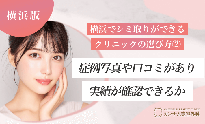 横浜でシミ取りができるクリニックの選び方②症例写真や口コミがあり実績が確認できるか
