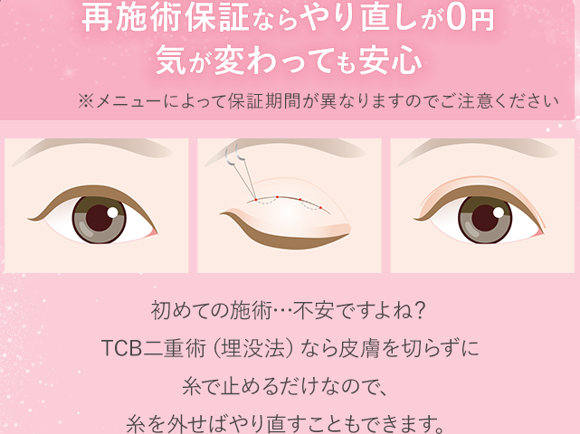 旭川でおすすめのTCBの二重整形の再施術保障の画像