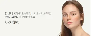 共立美容外科のしみ治療