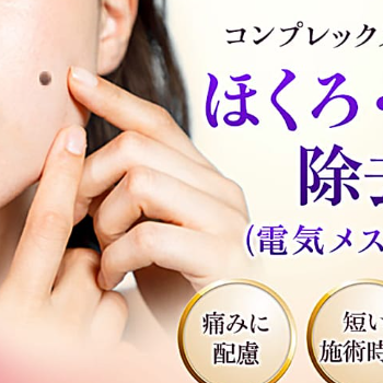 品川美容外科のほくろ除去のイメージ