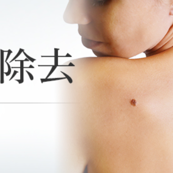 東京美容外科のほくろ除去のイメージ