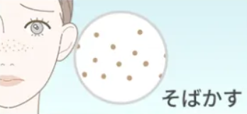 そばかす