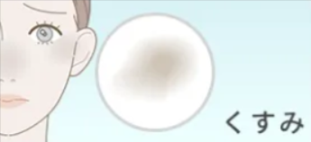 顔全体のくすみ