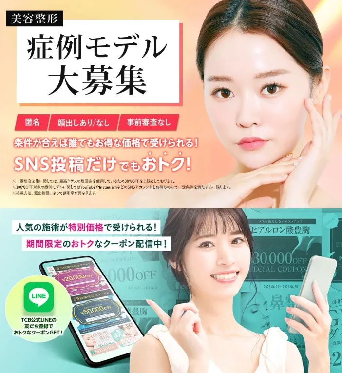 TCB東京中央美容外科のモニター制度・公式LINE