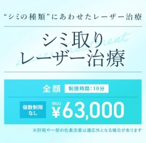 TCB東京中央美容外科のシミ取りレーザー治療