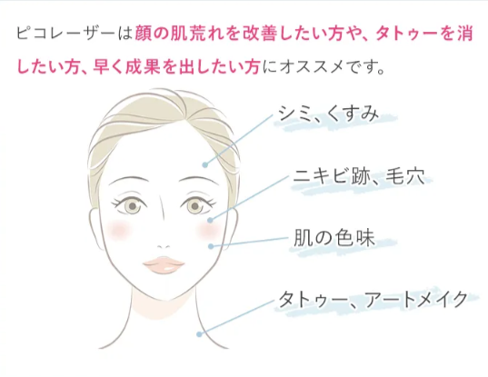 TCBのピコレーザー