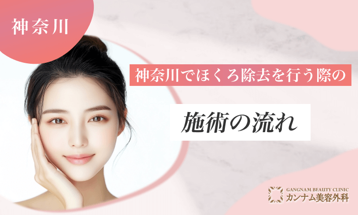 神奈川でほくろ除去を行う際の施術の流れ