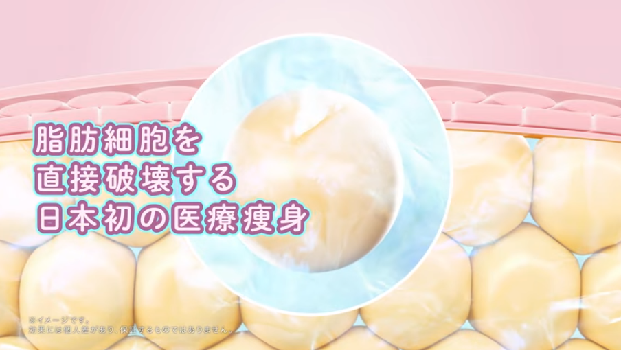 Junoのスルリム施術解説