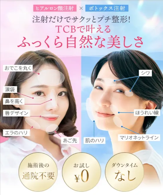 TCB東京中央美容外科のボトックス