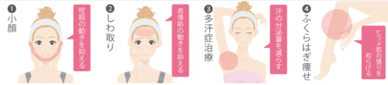 TCBのボトックス治療