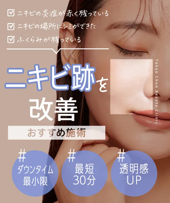 TCB東京中央美容外科のニキビ跡治療