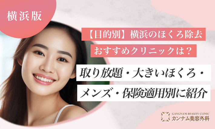 【目的別】横浜のほくろ除去おすすめクリニックは？