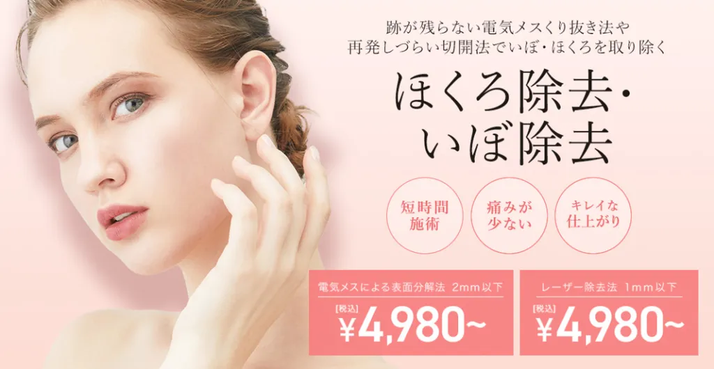 口コミが良いTCBのほくろ除去の紹介画像