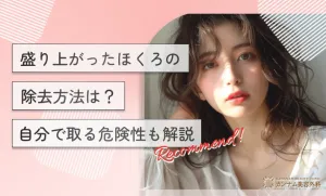 盛り上がったほくろの除去方法は？自分で取る危険性も解説